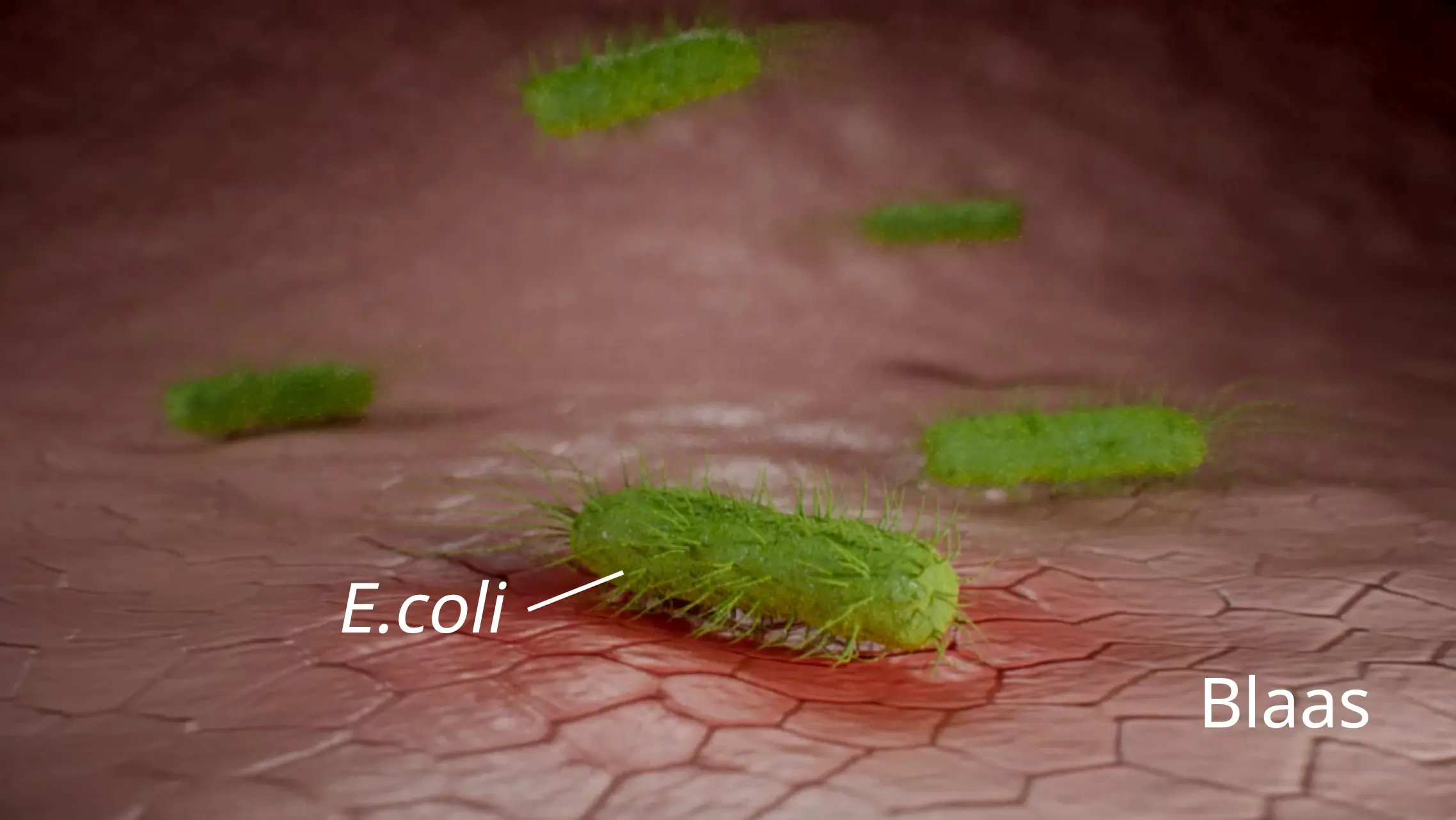 Blaasontsteking veroorzaakt buikpijn.