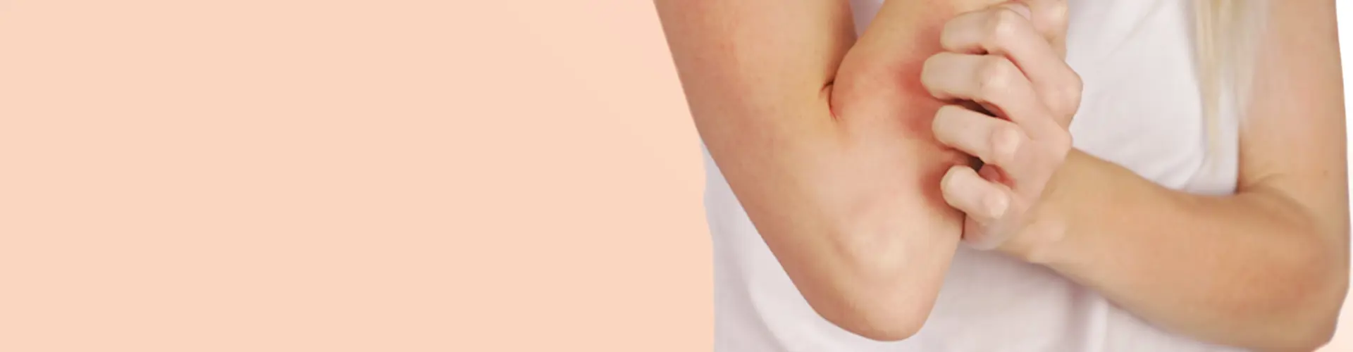 Lisez tout sur l'eczéma sur cette page.