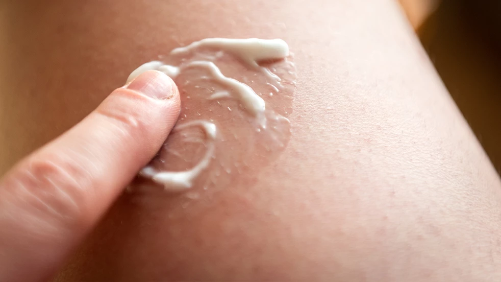 Le traitement d'une réaction cutanée allergique est généralement symptomatique.