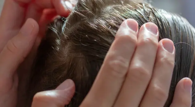 De preventie van luizen omvat het controleren van het haar, maar ook het verwittigen van de school wanneer je kind luizen heeft.