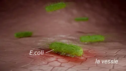 Een branderig gevoel tijdens het plassen kan ook bij een vrouw voorkomen