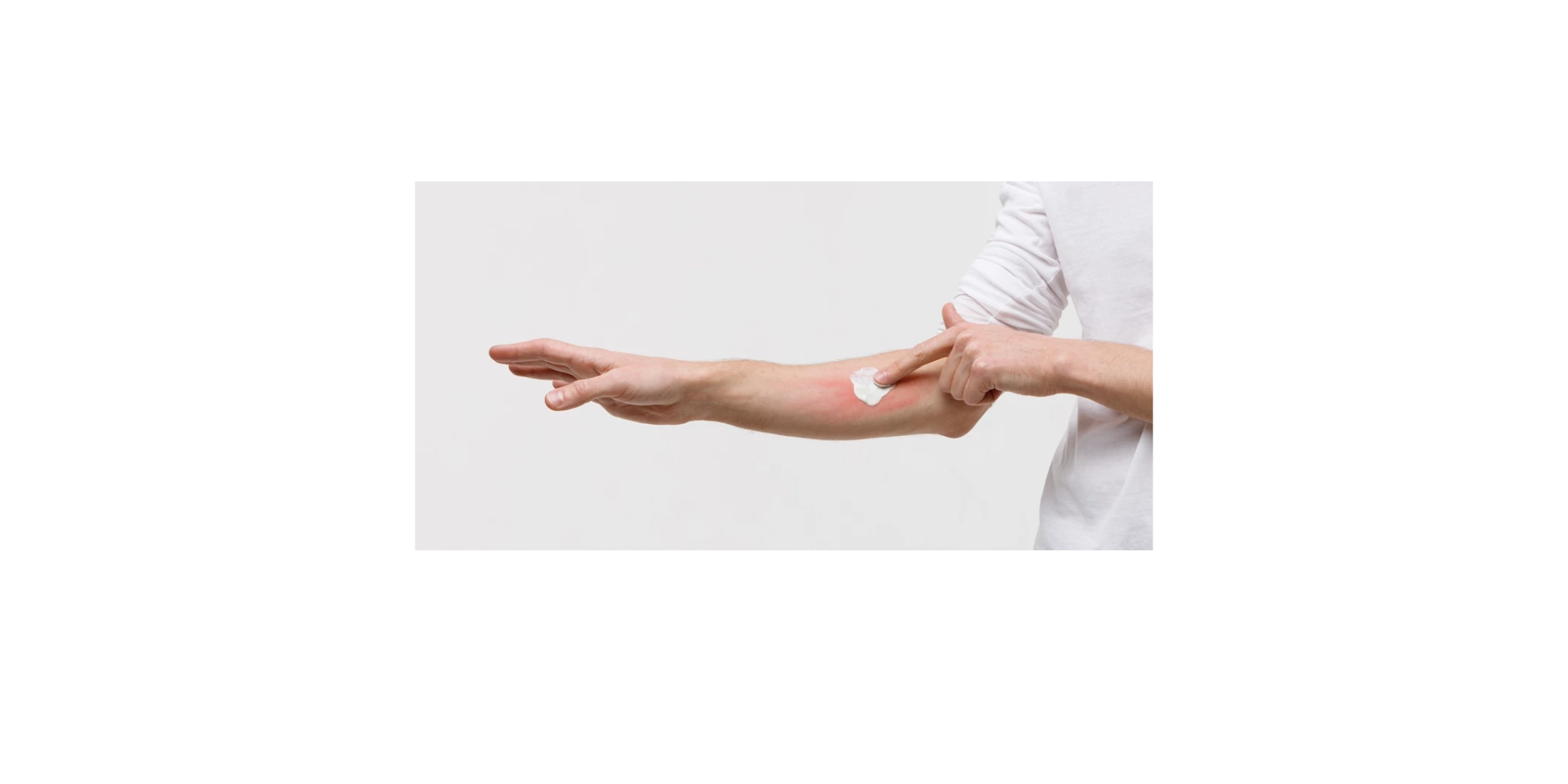 Utilisez une crème pour réduire vos démangeaisons