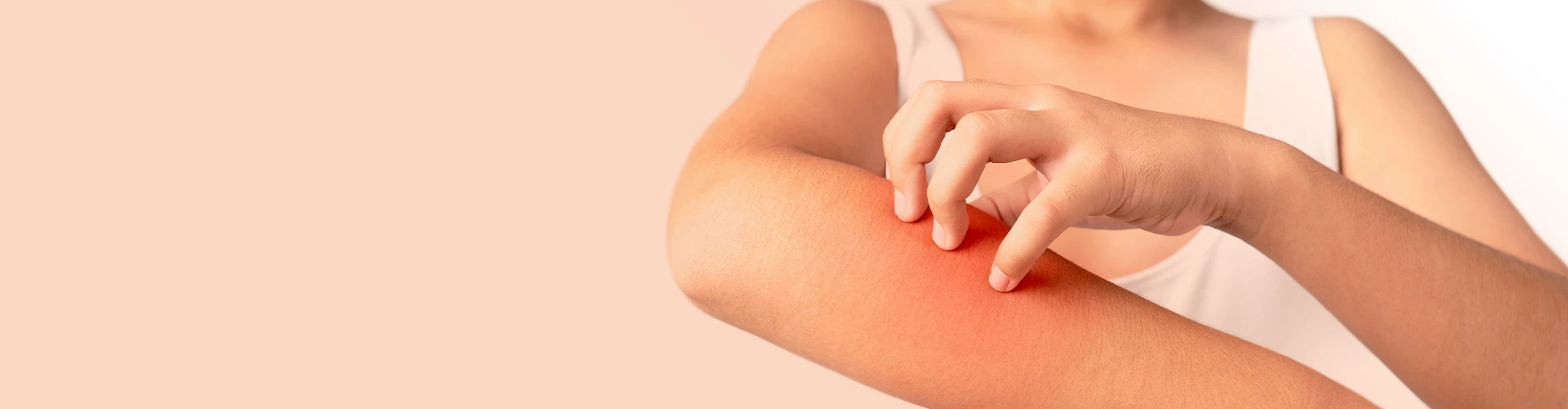 Ontdek op deze pagina alles over een allergische huidreactie.