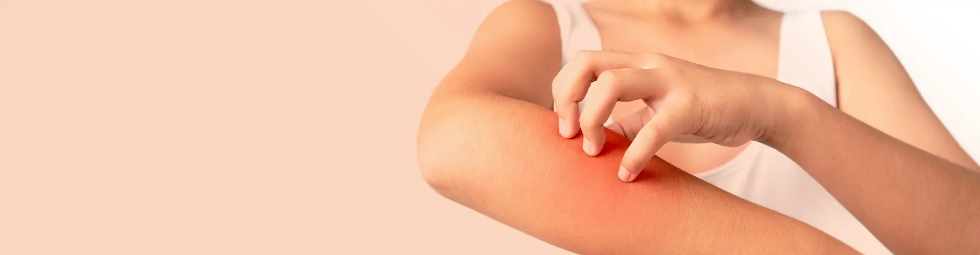 Découvrez tout sur une réaction allergique de la peau sur cette page.