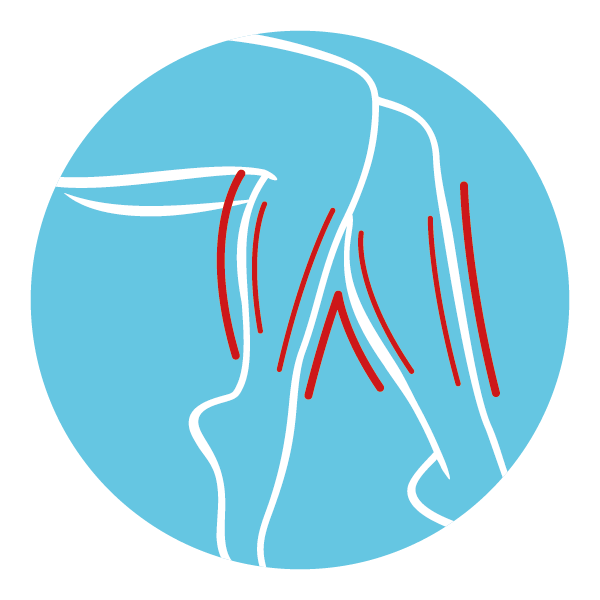 Pijnlijke benen verlichten