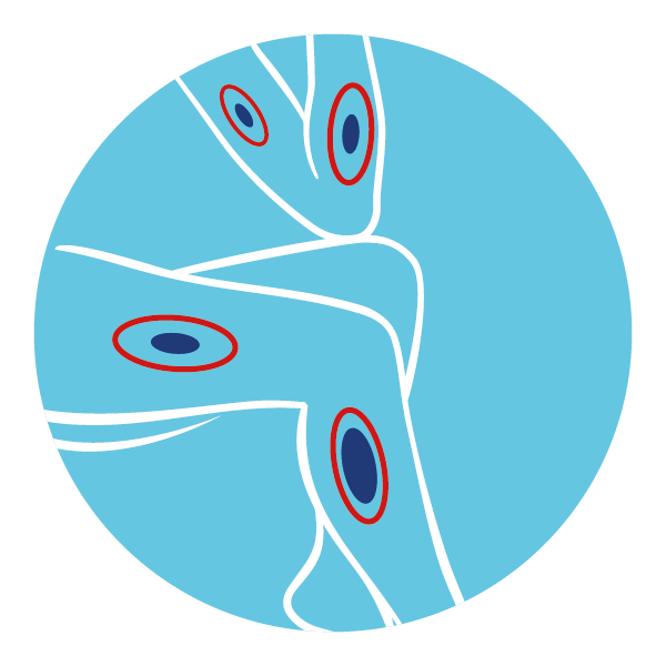 accélérer la disparition des hématomes