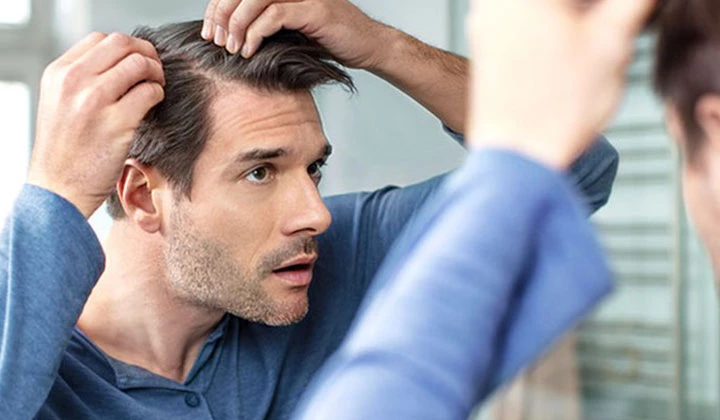 Ketoconazol als actief bestanddeel in een shampoo helpt om roos onder controle te krijgen.