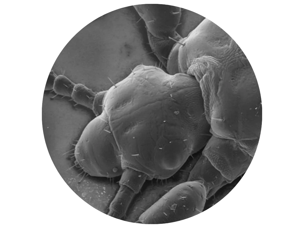 Hoe zien luizen en neten eruit?