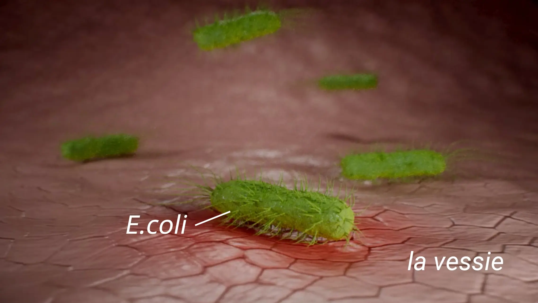 Vous avez mal en urinant ? Vérifiez s’il ne s'agit pas d'une infection de la vessie.
