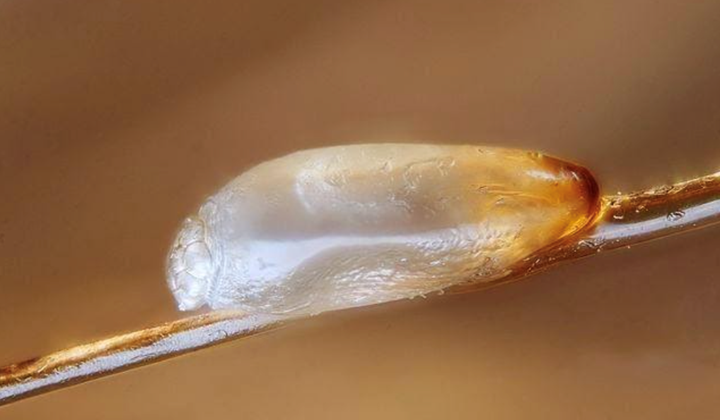 Le cycle de vie du pou