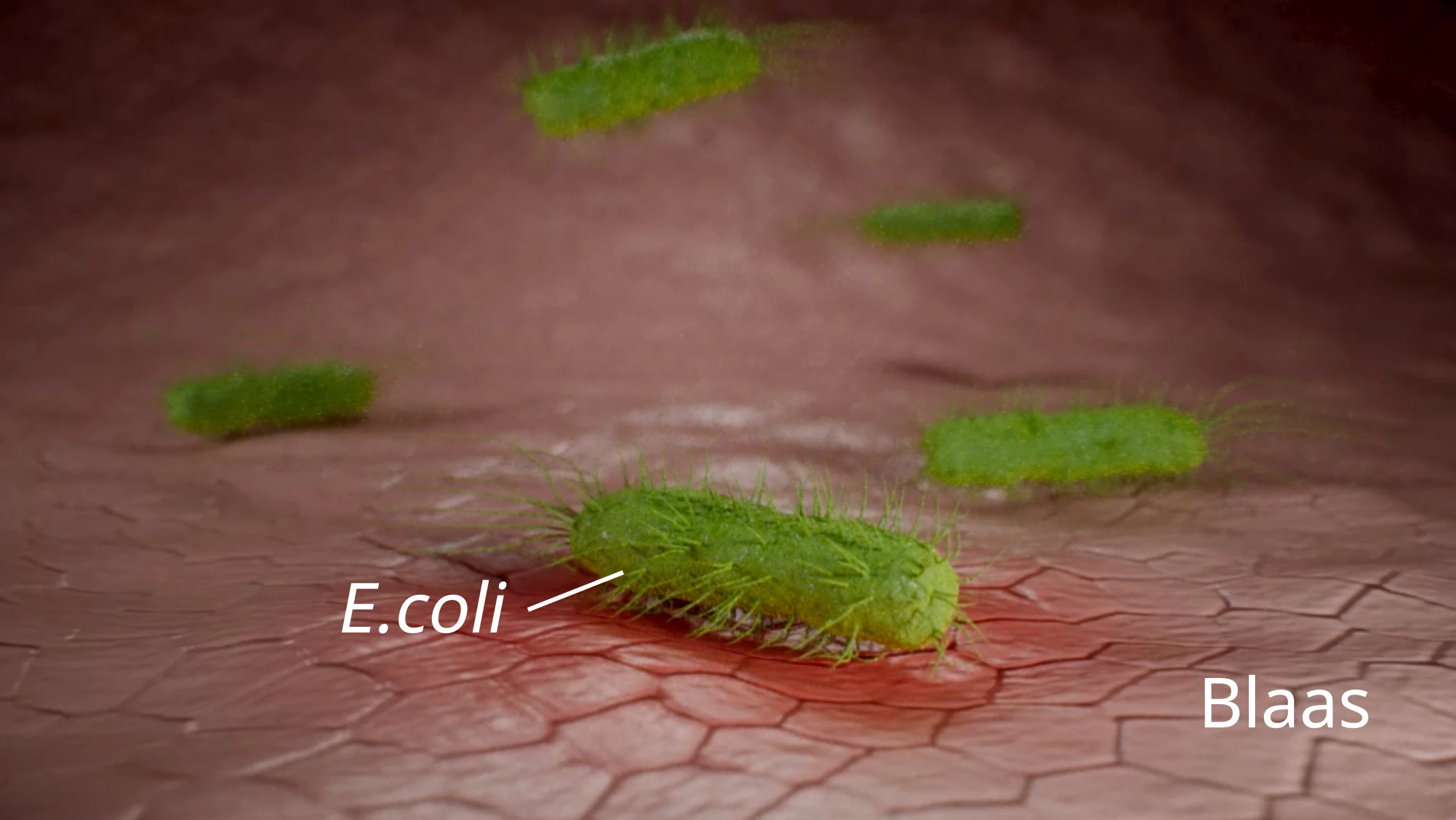 Blaasontsteking veroorzaakt buikpijn.