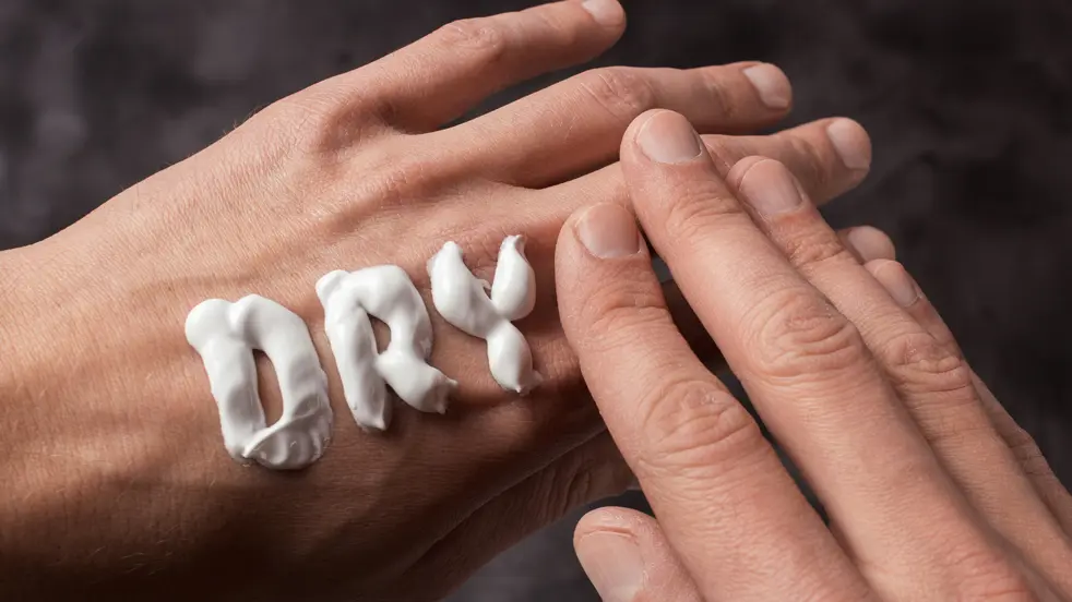 Une peau sèche est également souvent considérée comme une cause d'eczéma.